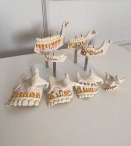 Teeth Eruption Stages Oral Maxilla and Mandible