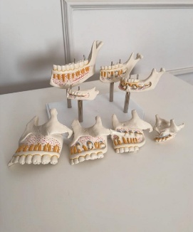Teeth Eruption Stages Oral Maxilla and Mandible